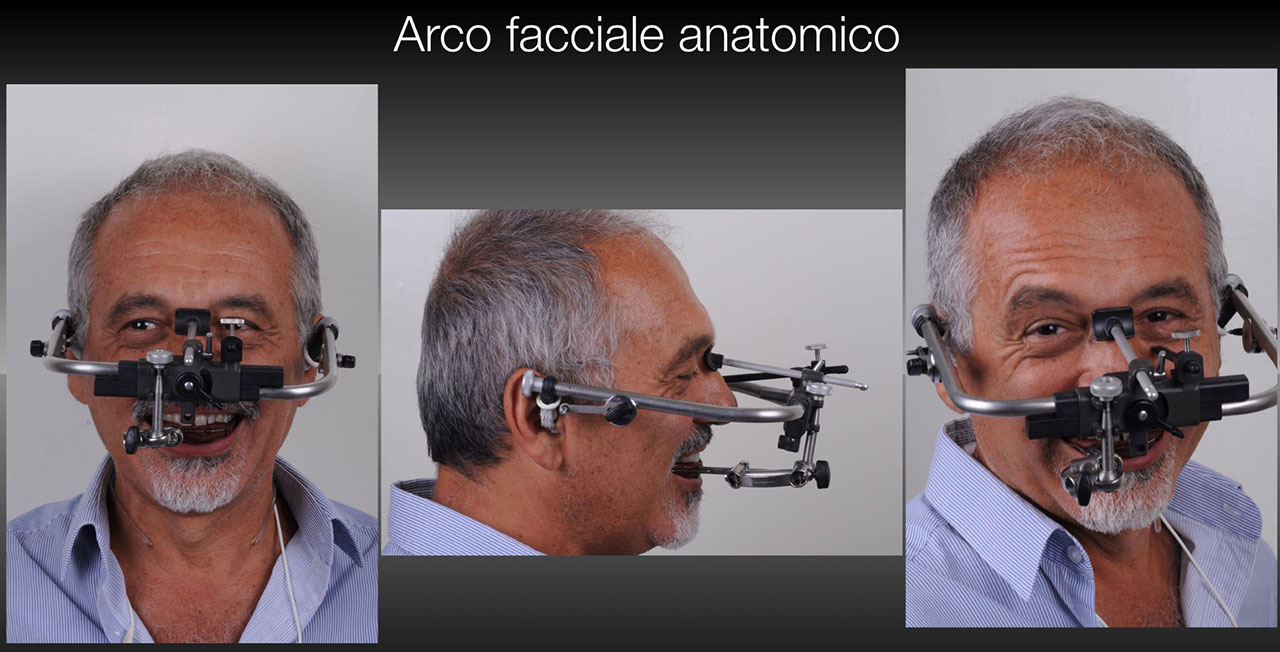 acro facciale anatomico