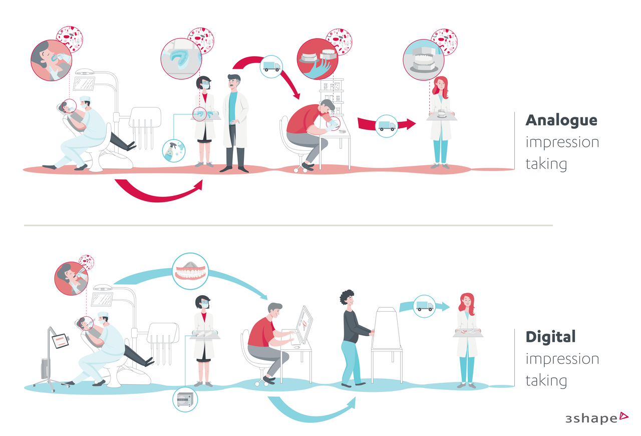 With analog impressions your workflow needs extra steps, including material handling and transportation to the lab.