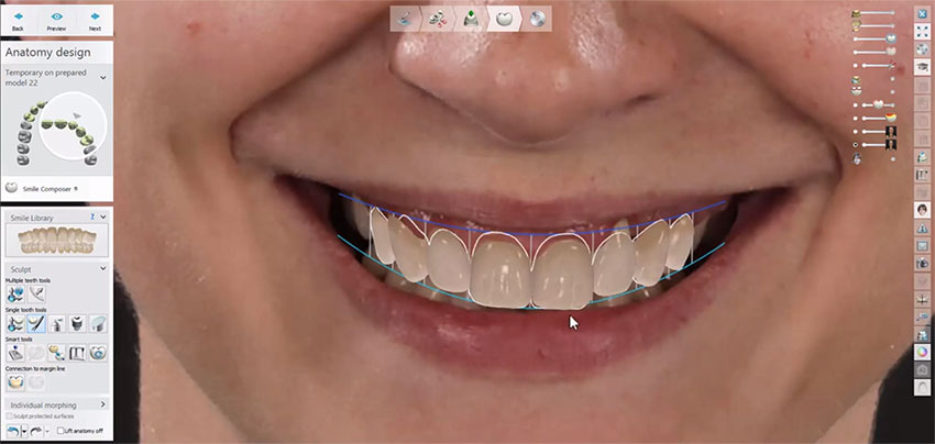 Smile Design improve patient perception