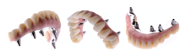 Documenting dentistry case