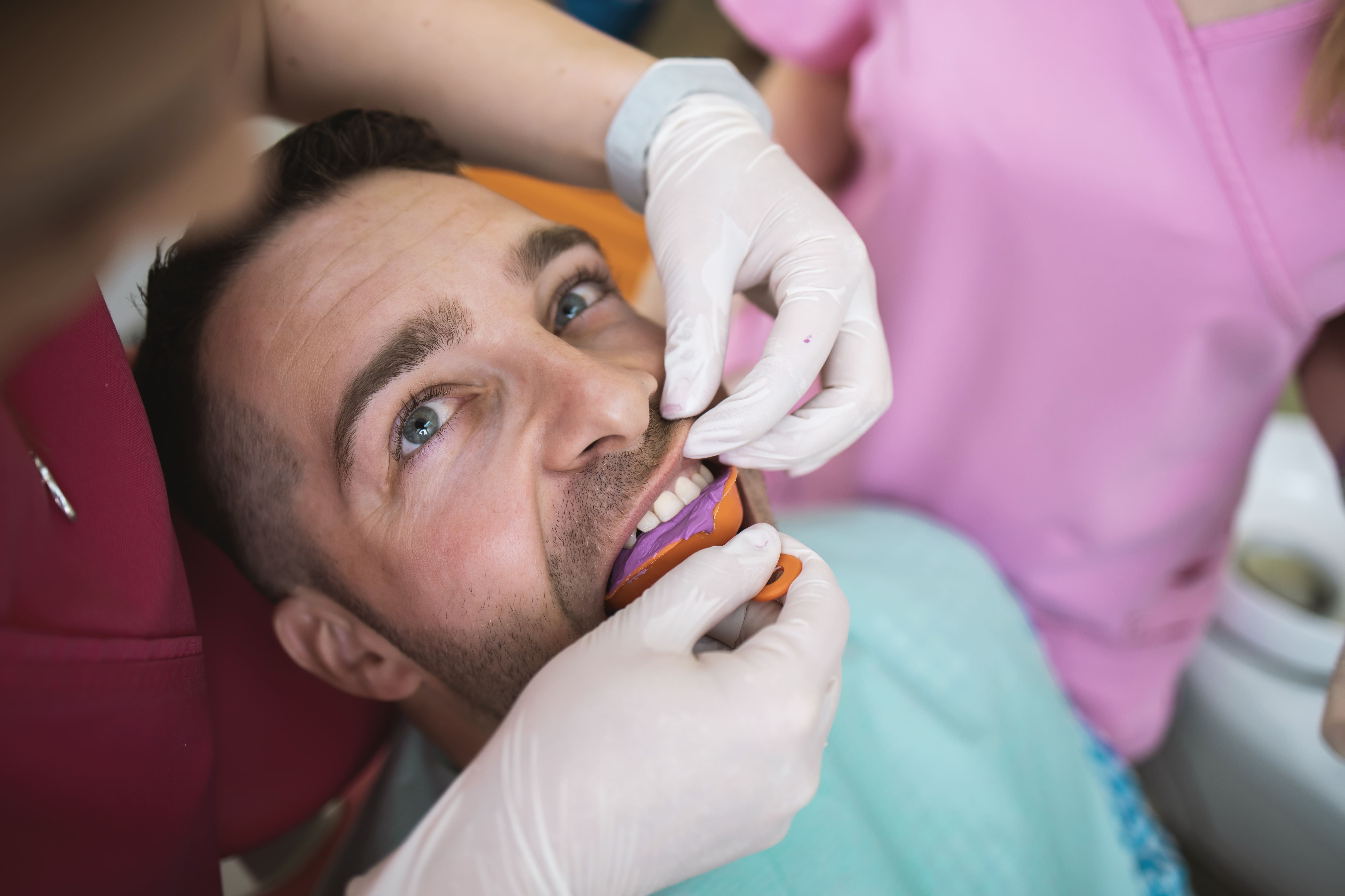 traditional impressions in dentistry