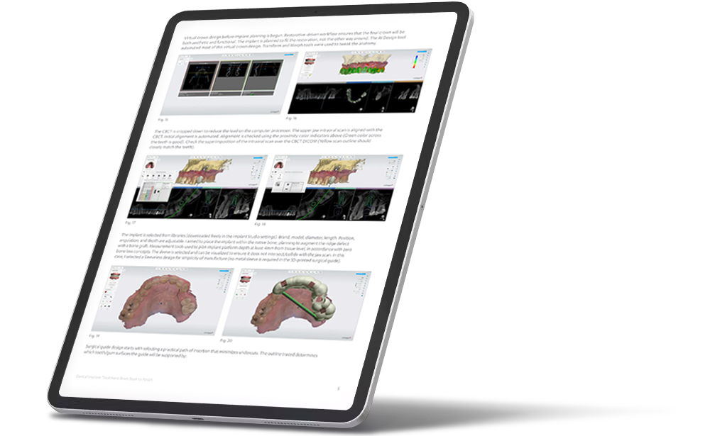 ipad case study