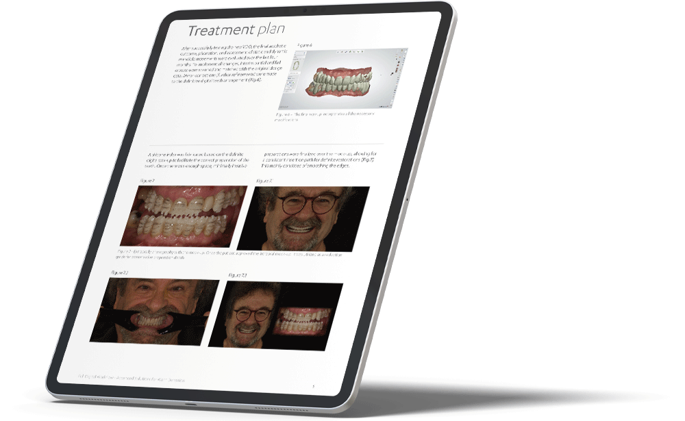  Advanced Solutions for  Worn Dentition iPad