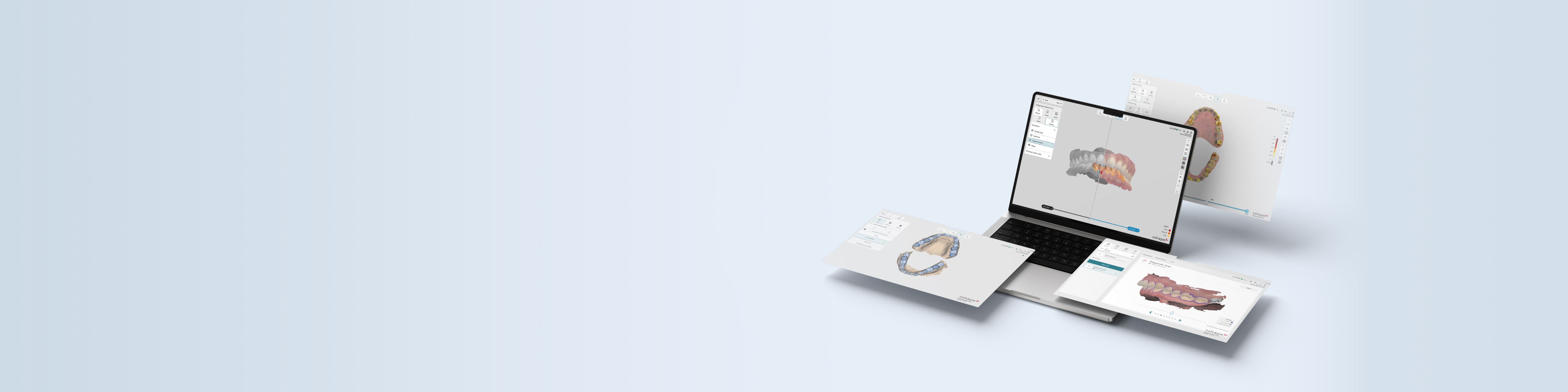 Dental System software interface displayed