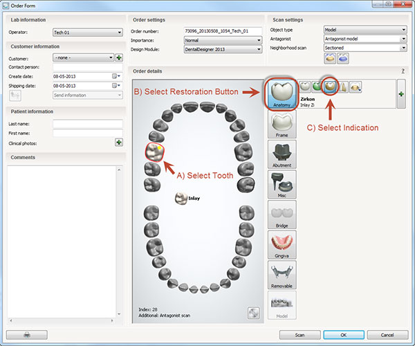 Restoration buttons in the Order Form 2013