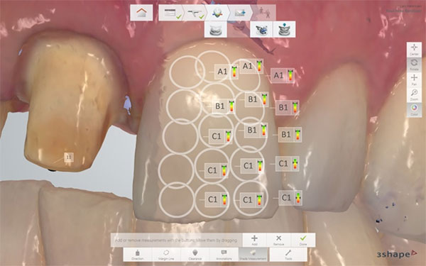 Dentist evaluates img4