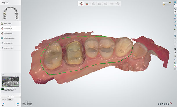 Prepare the scan before design - Trim the scan