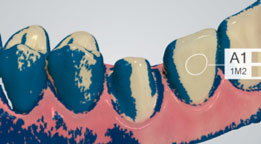 using shade measurement 12