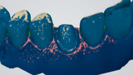 using shade measurement 14