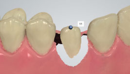 using shade measurement 16