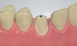 using shade measurement 17