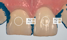 using shade measurement 6