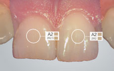 using shade measurement 7