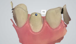 using shade measurement 8