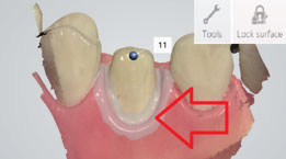using shade measurement 9