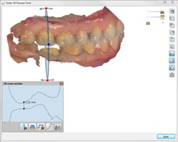 3D Preview option 3Shape