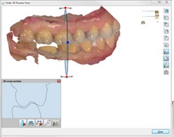 Measure distance to antagonist
