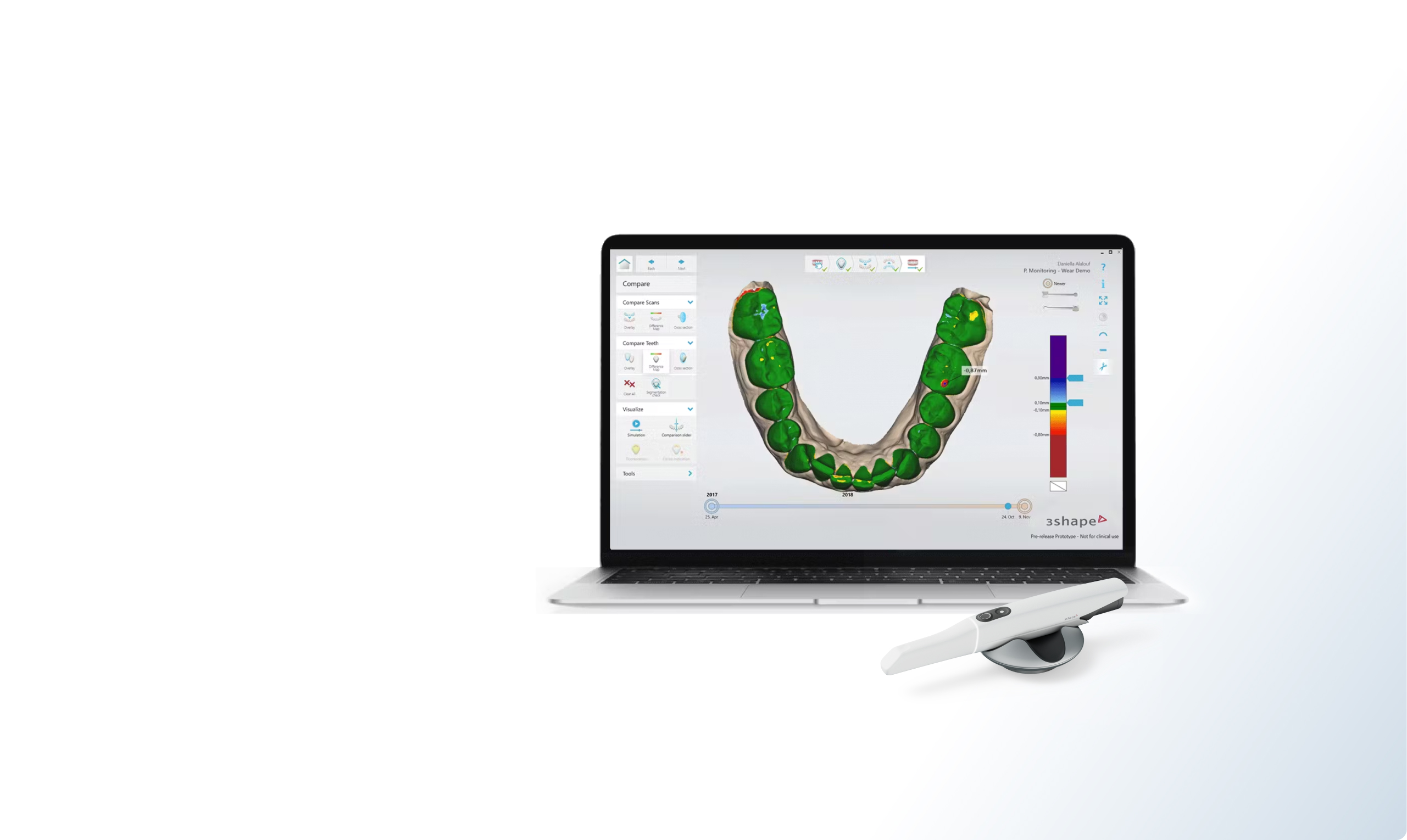 TRIOS 5 scanner with Dental System
