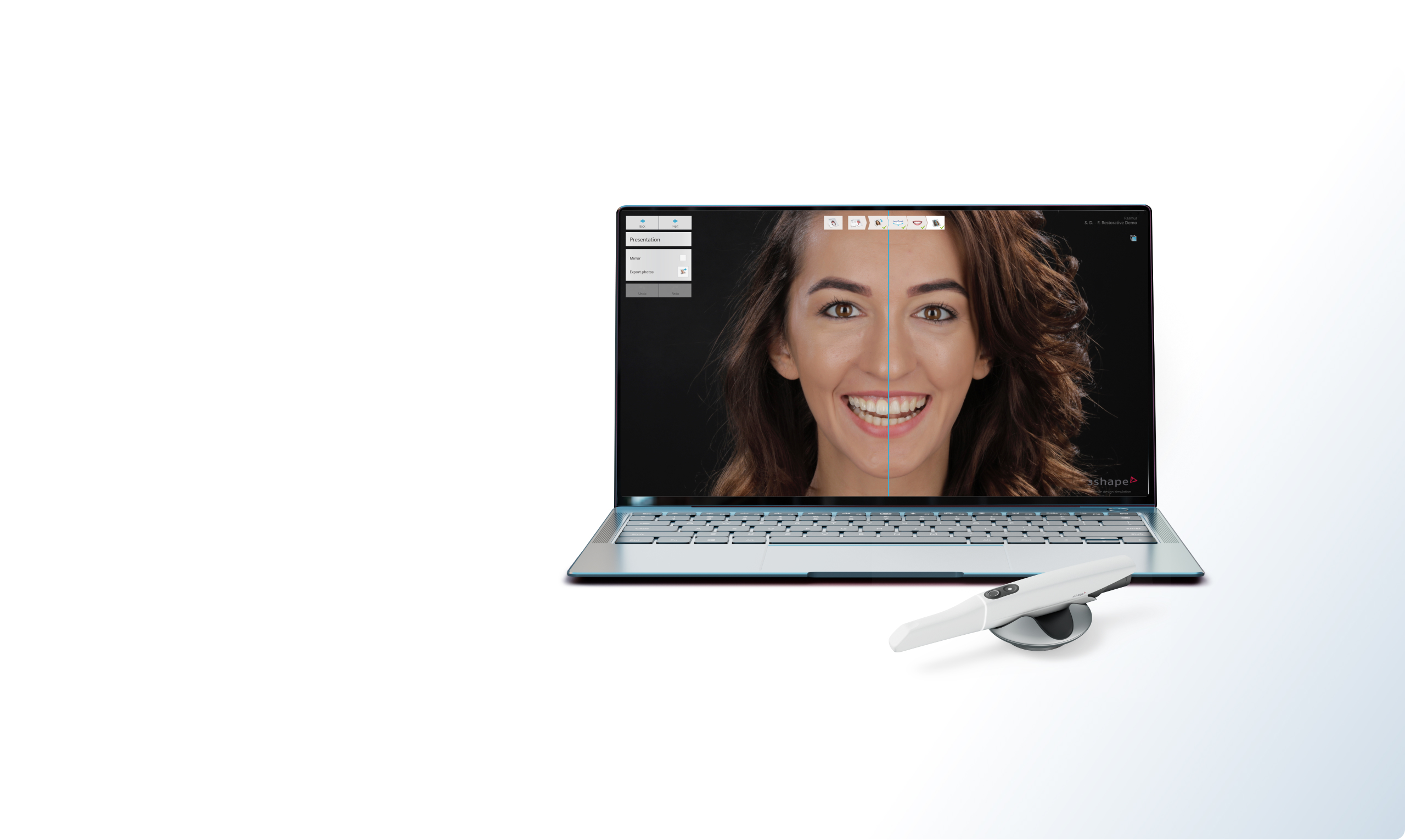 TRIOS Smile Design으로 환자의 미소와 삶 향상