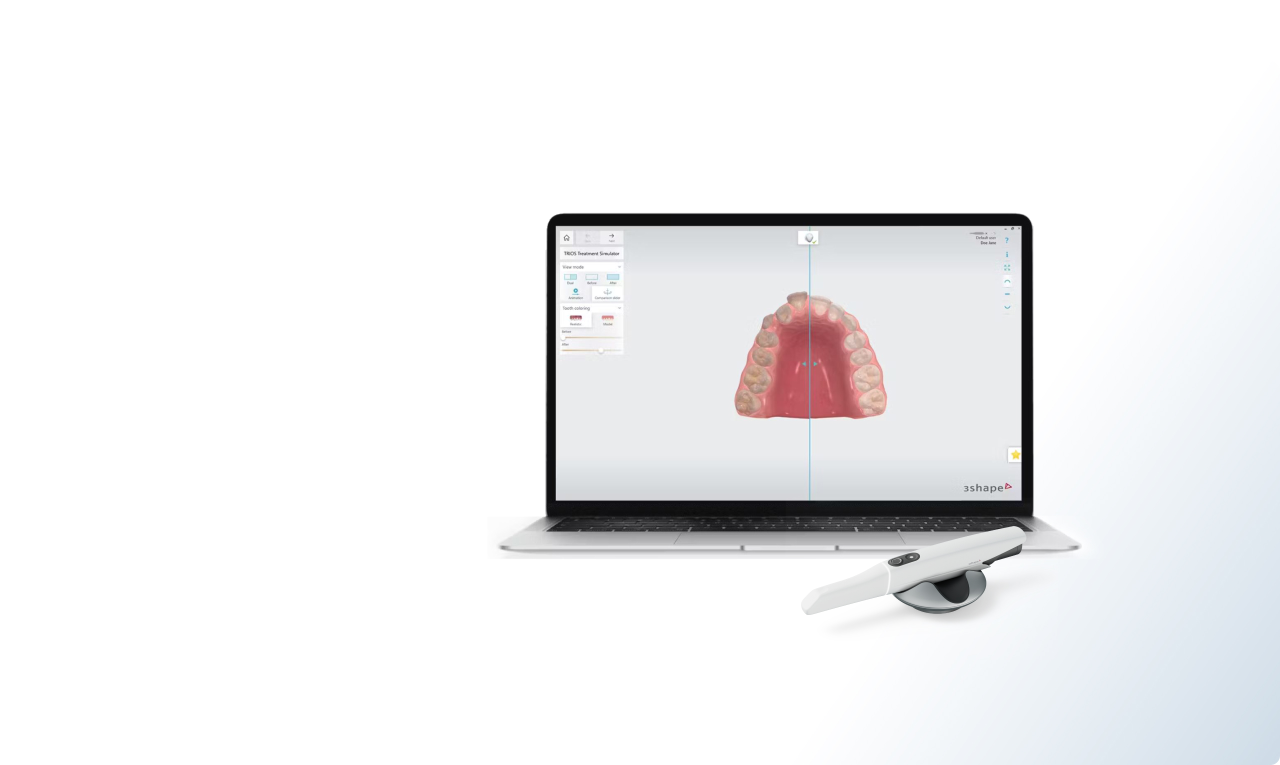 Corrections orthodontiques à l'écran